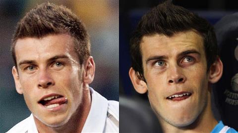 Chuyện chưa kể về Gareth Bale: Đời thay đổi khi... tai thay đổi
