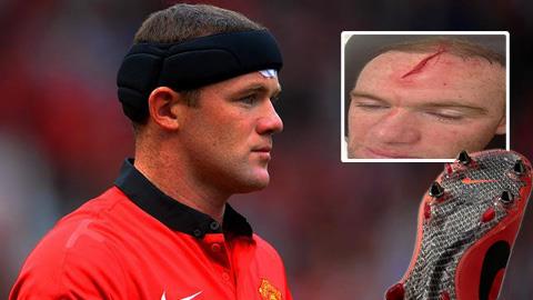 PFA muốn hạn chế chấn thương kiểu Rooney vì giày hybrid