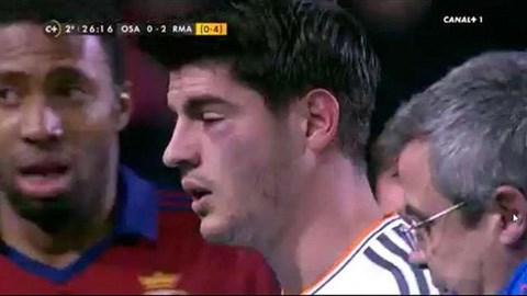 Mắt sưng húp, Morata rời sân chỉ sau 20 phút