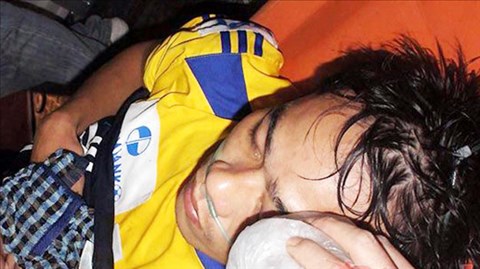 Những vụ chấn thương kinh hoàng của bóng đá Việt Nam