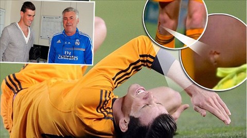 Thủng đầu gối, Bale vẫn nén đau đi tập