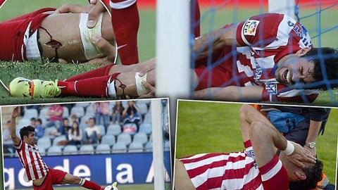Diego Costa lại dính chấn thương nghiêm trọng?