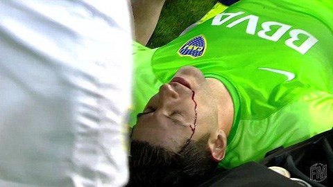 Thủ môn của Boca Juniors bị ném đá chảy máu đầu