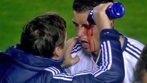 Ronaldo lỡ dịp gặp lại kẻ khiến mình... lĩnh sẹo