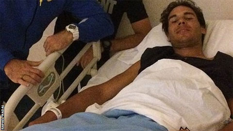 Rafael Nadal hồi phục nhanh sau phẫu thuật