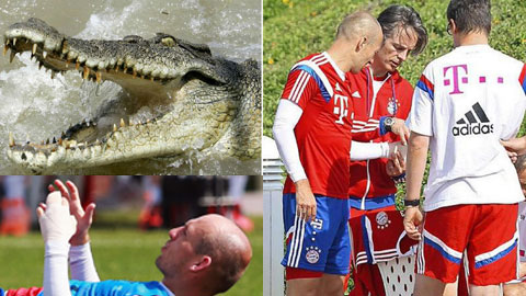 Sau giờ bóng lăn 18/1: Robben suýt mất tay vì… cá sấu
