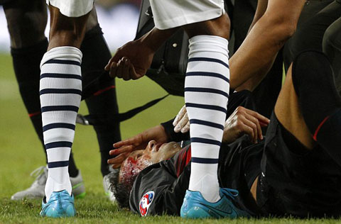 Hậu vệ Ricardo Carvalho của Bồ Đào Nha đổ máu do bị Patrice Evra đá vào mặt