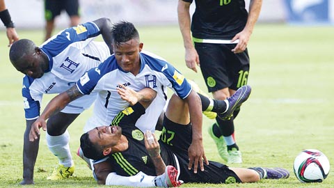 Luis Garrido (in white) of Honduras suffers a broken leg against Mexico Read more at http://www.worldsoccer.com/features/photos-of-the-month-december-2015-366030#d6tbDXYU2Gz7p6Ih.99