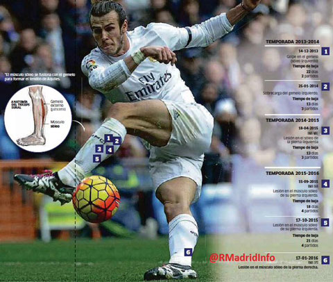 Lịch sử chấn thương bắp chân của Bale