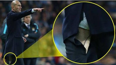 Chỉ đạo máu lửa, Zidane một lần nữa lại... rách quần