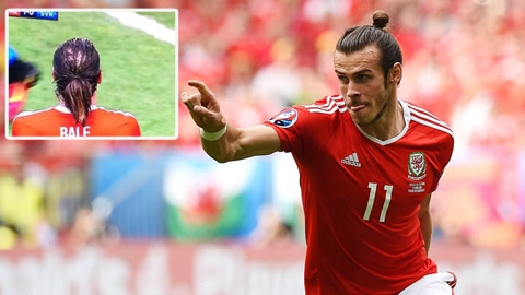 Bale sắp... hói đầu vì thích để tóc dài?