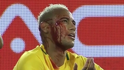 Chảy máu đầm đìa, hung thủ vẫn chưa tha Neymar