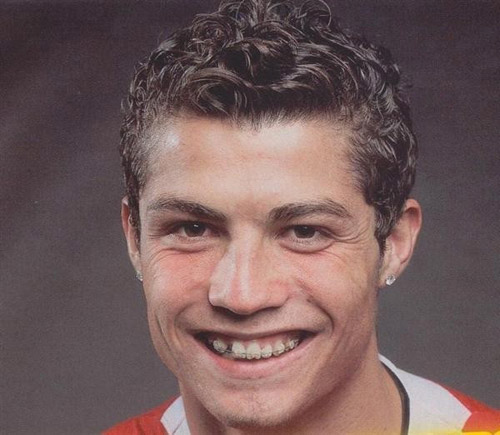 Ronaldo đã chi rất nhiều tiền để làm lại răng sau khi chụp tấm hình này