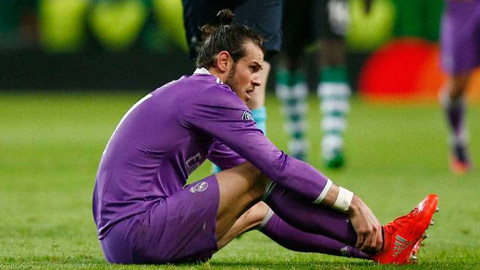 Dính chấn thương, Gareth Bale lỡ hẹn Siêu kinh điển