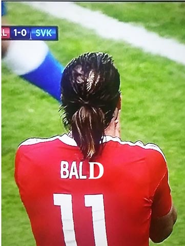 Bale không giấu được chuyện hói nữa và tên anh bị CĐV đổi từ BALE thành BALD (hói đầu)