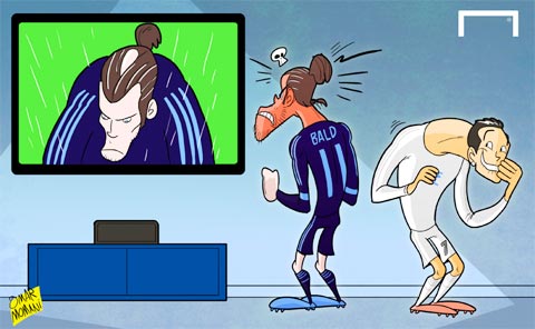 Bale hói thành đề tài châm biếm