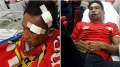 CĐV Malaysia bị tố hành hung CĐV Myanmar
