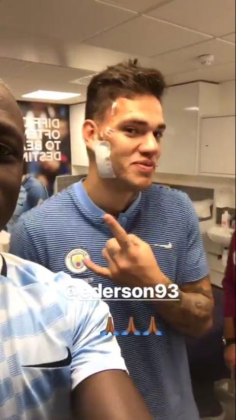 Ederson tuyên bố sẵn sàng ra sân ở Champions League giữa tuần này