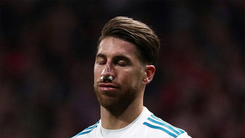 Ramos đăng ảnh khoe mũi dần hồi phục