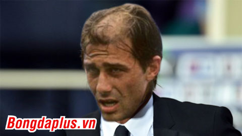 Ảnh chế: Conte sắp sạch tóc vì West Ham