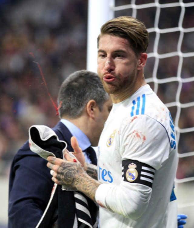 Ramos đổ máu trong trận Real bị Atletico cầm hòa trên sân Wanda Metropolitano hồi tháng 11 vừa qua