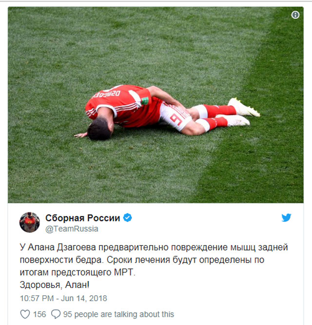 Dzagoev nguy cơ sớm chia tay World Cup 2018