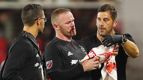 Hậu trường sân cỏ 30/7: Rooney đổ máu ở MLS