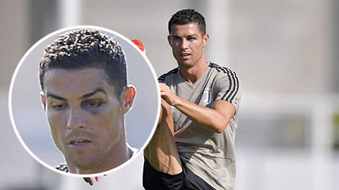 Ronaldo mắt thâm quầng trong buổi tập với Juventus
