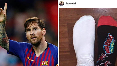 Messi tham gia thử thách đi tất cọc cạch