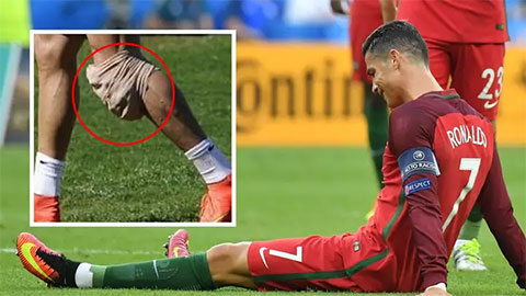 Ronaldo dính chấn thương 'vô phương cứu chữa' suốt 6 năm qua