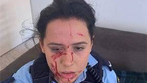 Nữ cảnh sát chấn thương nghiêm trọng trong ngày Leeds United vô địch Championship