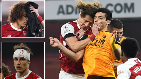 Raul Jimenez và David Luiz ngã vật ra bất động sau pha “đấu đầu” cực mạnh ở trận Arsenal gặp Wolves rạng sáng qua