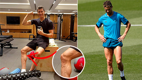 Lewandowski sở hữu bắp chân cuồn cuộn không kém Ronaldo