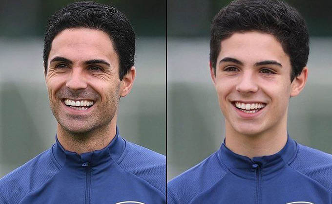 Nụ cười tươi rói không hề thay đổi của HLV Mikel Arteta (Arsenal)