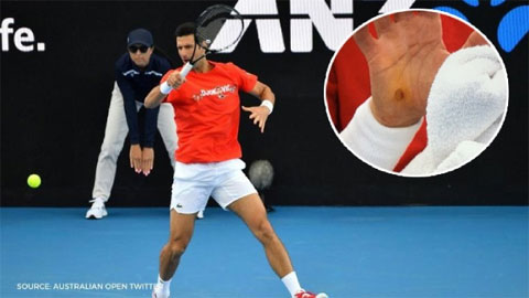 Djokovic dính chấn thương tay ở  Adelaide