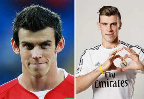 Bale vừa đẹp, vừa hay hơn sau khi sửa tai