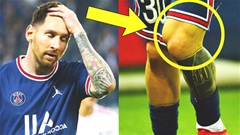 Chấn thương của Messi nghiêm trọng hơn dự đoán ban đầu
