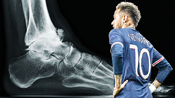 Neymar đã phải gặp những chấn thương tồi tệ trong sự nghiệp