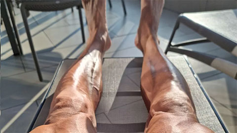 Sốc với đôi chân của Ibrahimovic sau phẫu thuật