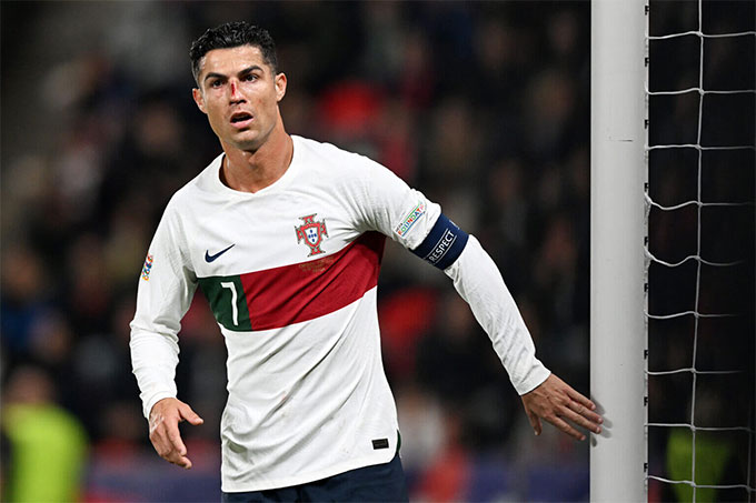 Dù chảy máu hay xuống phong độ, Ronaldo vẫn là số 1 trong lòng Santos