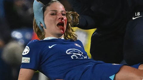 Mặt sao nữ Chelsea be bét máu khi bị đối phương chơi xấu