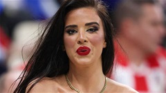 Ivana Knoll: CĐV gợi cảm nhất World Cup lại khiến fan 'xịt máu mũi'