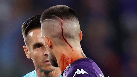 Đội trưởng Fiorentina đổ máu vì hành động xấu xí của các fan West Ham