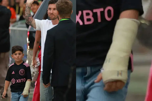 Cậu út nhà Messi xuất hiện với cánh tay bó bột