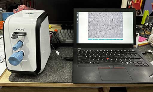 Hình ảnh clip tinh trùng thực tế qua xét nghiệm tinh dịch đồ bằng SQA-VU 