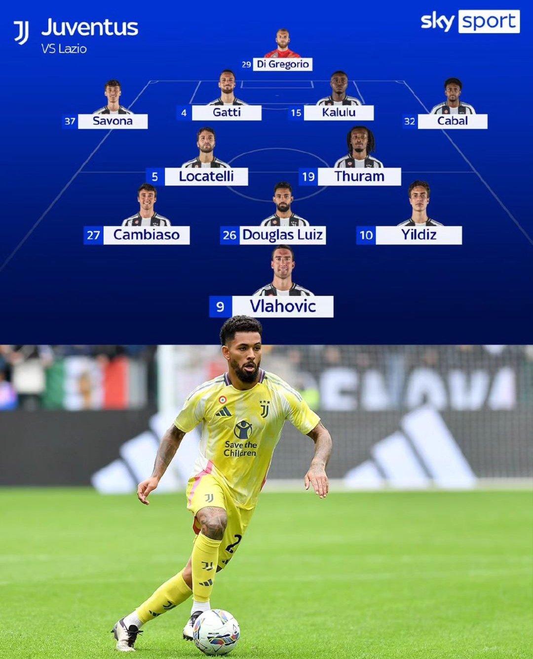 Đây có thể là thời điểm để Motta đặt niềm tin vào Douglas Luiz?