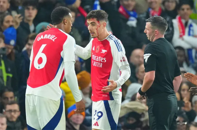 Havertz bị rách vết thương cũ
