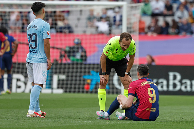Chấn thương của Lewandowski đang gây ra những vấn đề rất lớn cho Barca