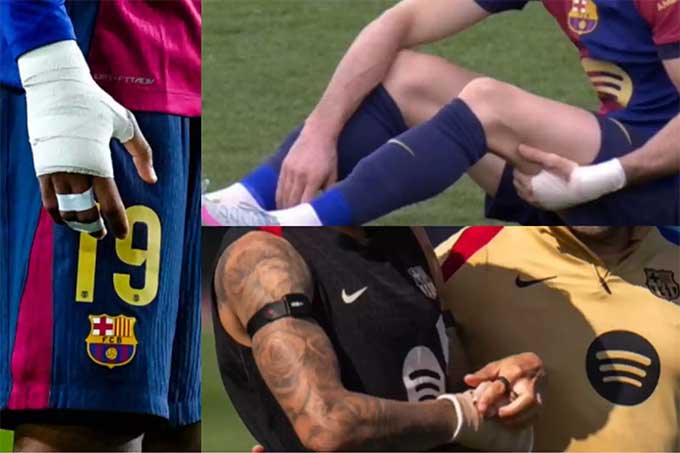 Cầu thủ Barca thường xuyên xuất hiện với băng quấn trắng ở tay.