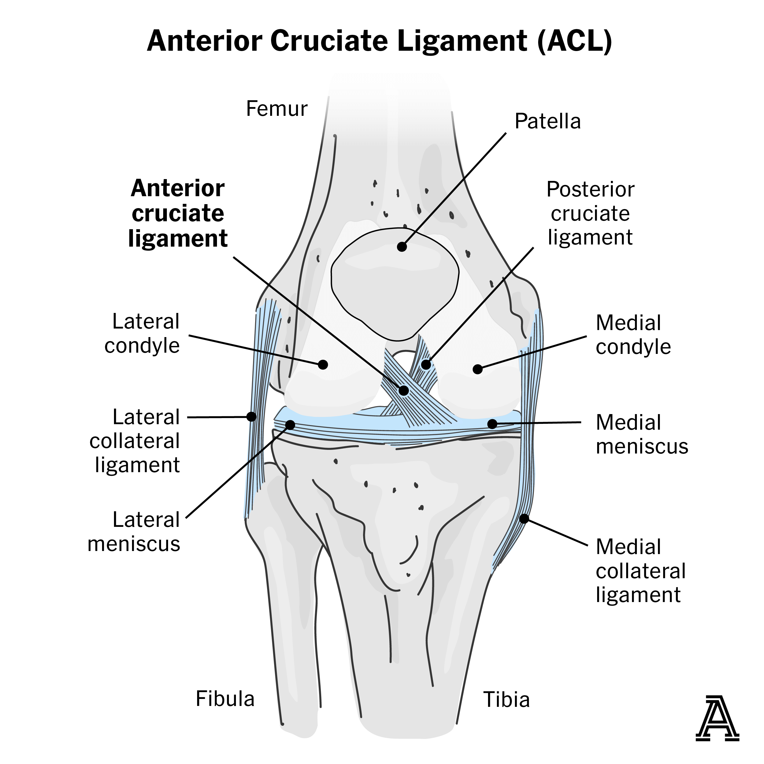 Đồ hình dây chằng chéo trong ACL